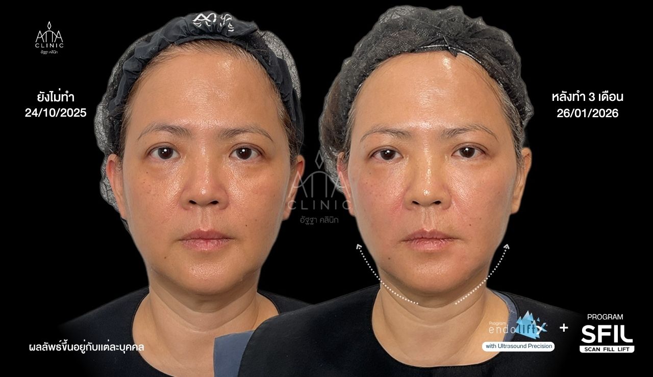 1.3 รูปคุณเพ็ง ผลลัพธ์ (1280 x 740 px)