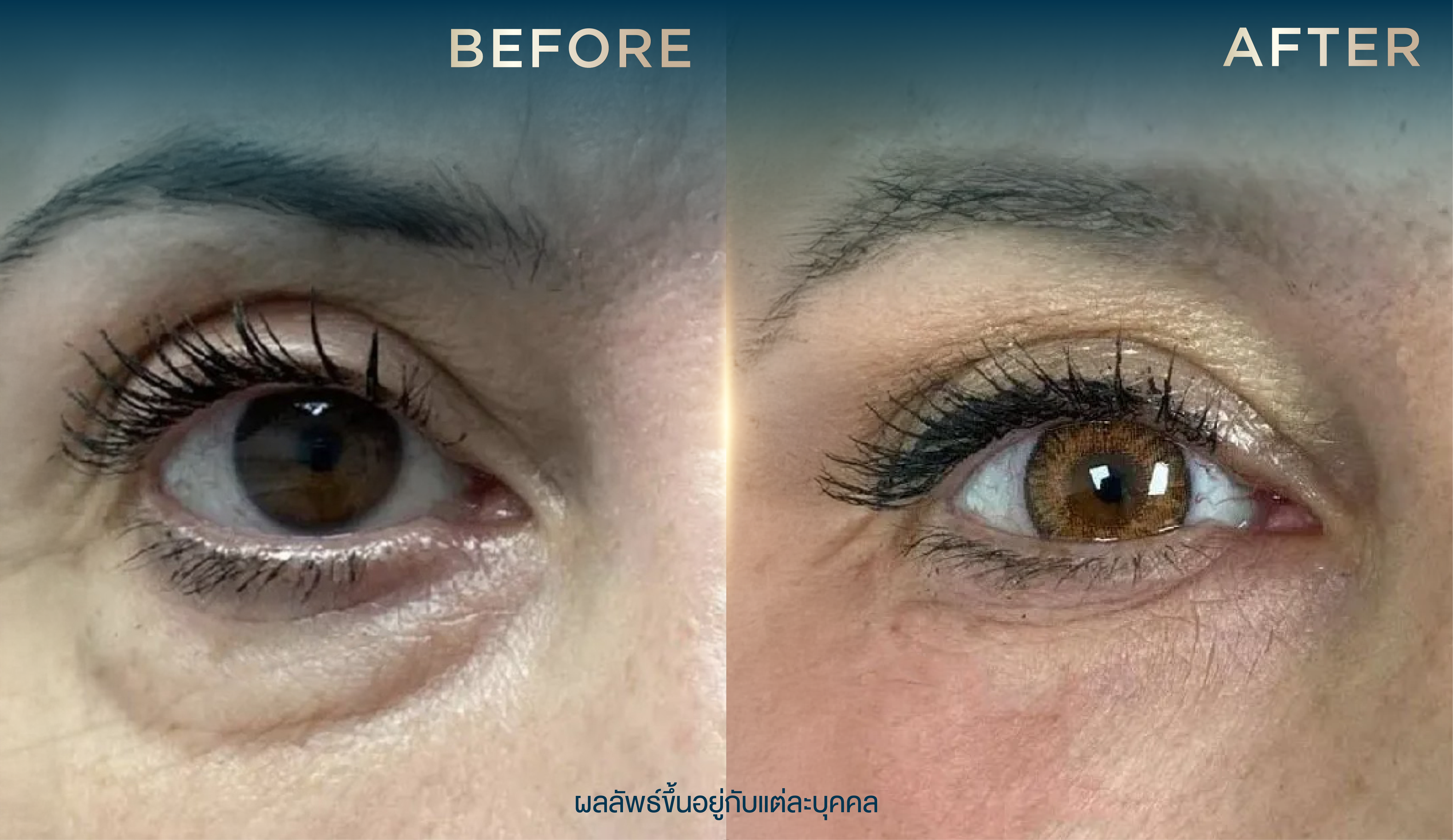 ATTA BEFORE AFTER BANNER 1280x740PX 05