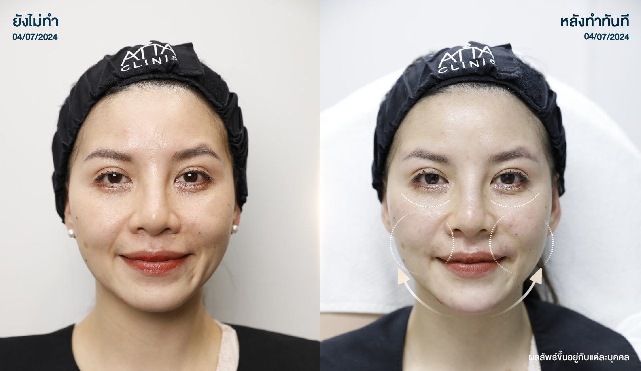 ATTA_BEFORE_AFTER_BANNER_1280x740PX