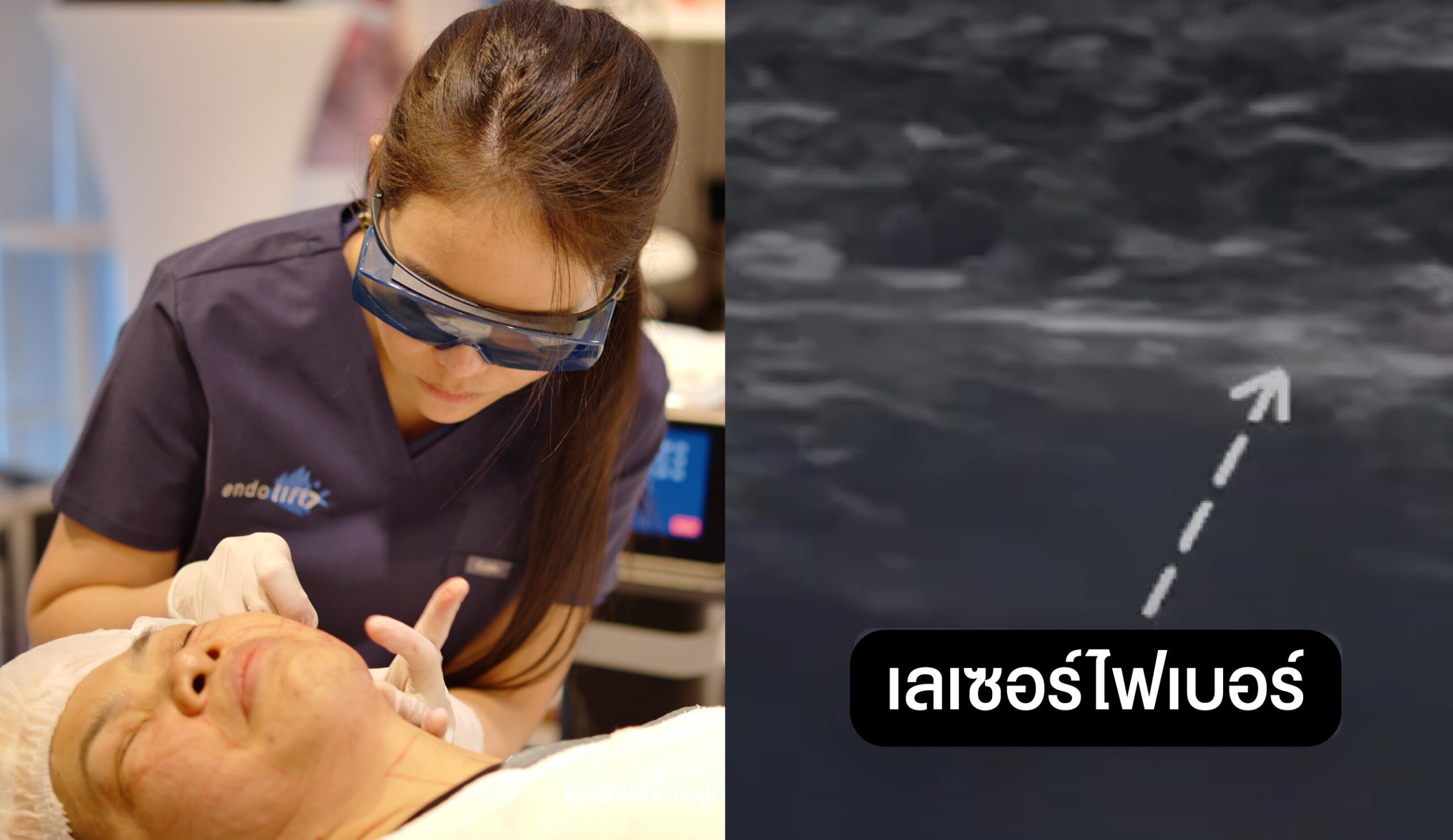 ATTA_BEFORE_AFTER_BANNER_1280x740PX