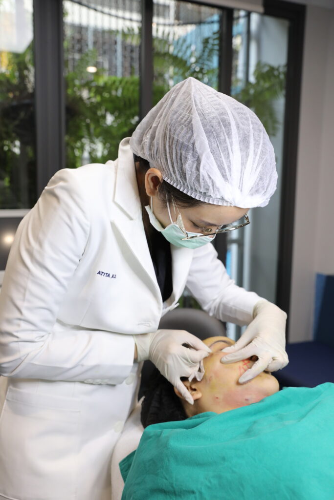 EndoliftX Ultrasound in Thailand