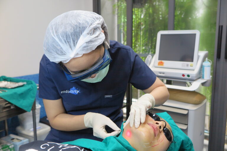 โปรแกรม Endolift เพื่อยกกระชับผิวหน้า