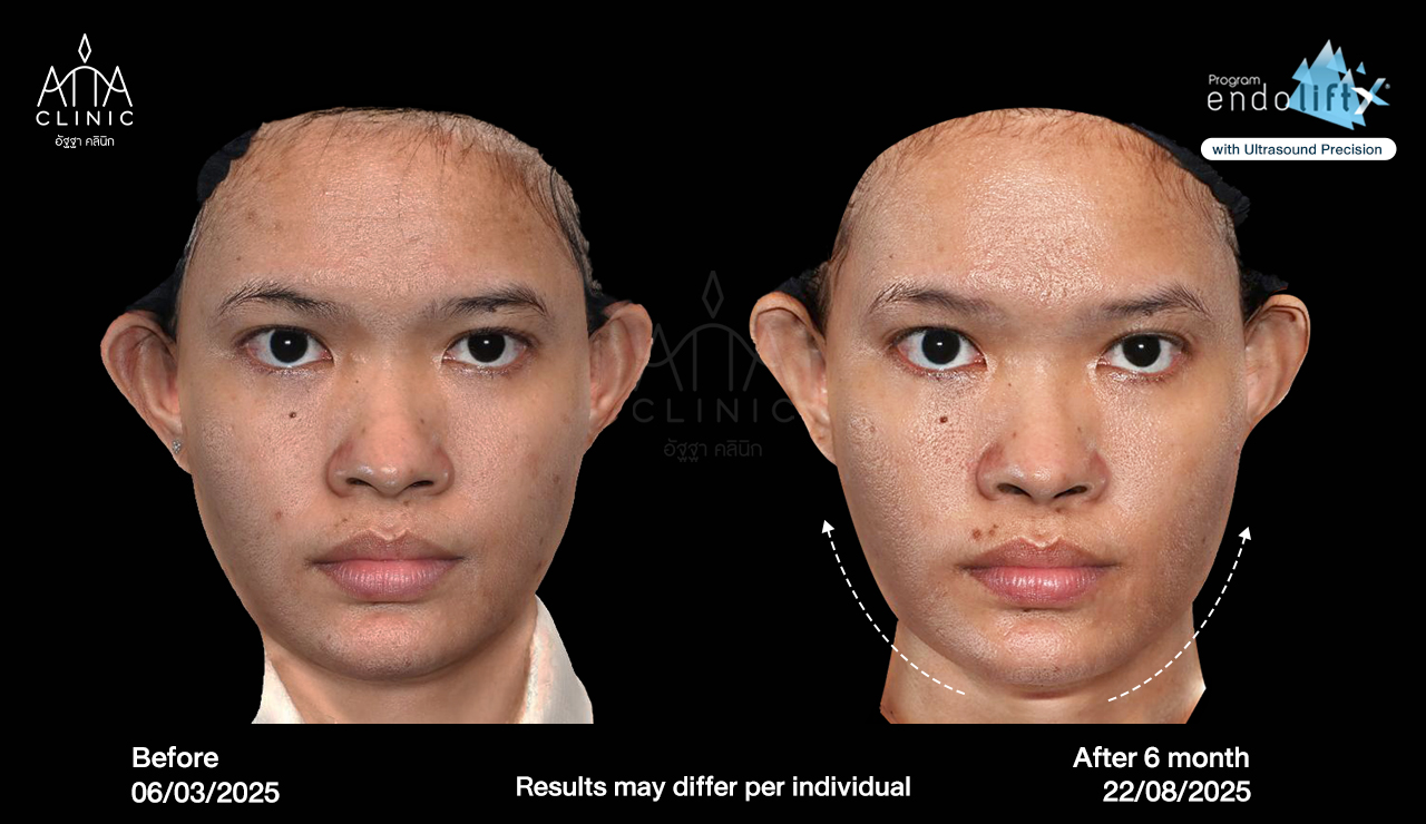 พี่น้ำนิ้ง1