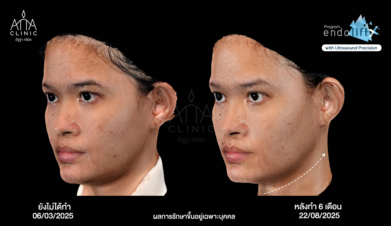 พี่น้ำนิ้ง2