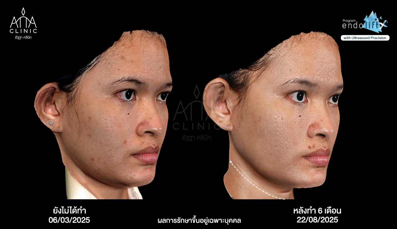 พี่น้ำนิ้ง3