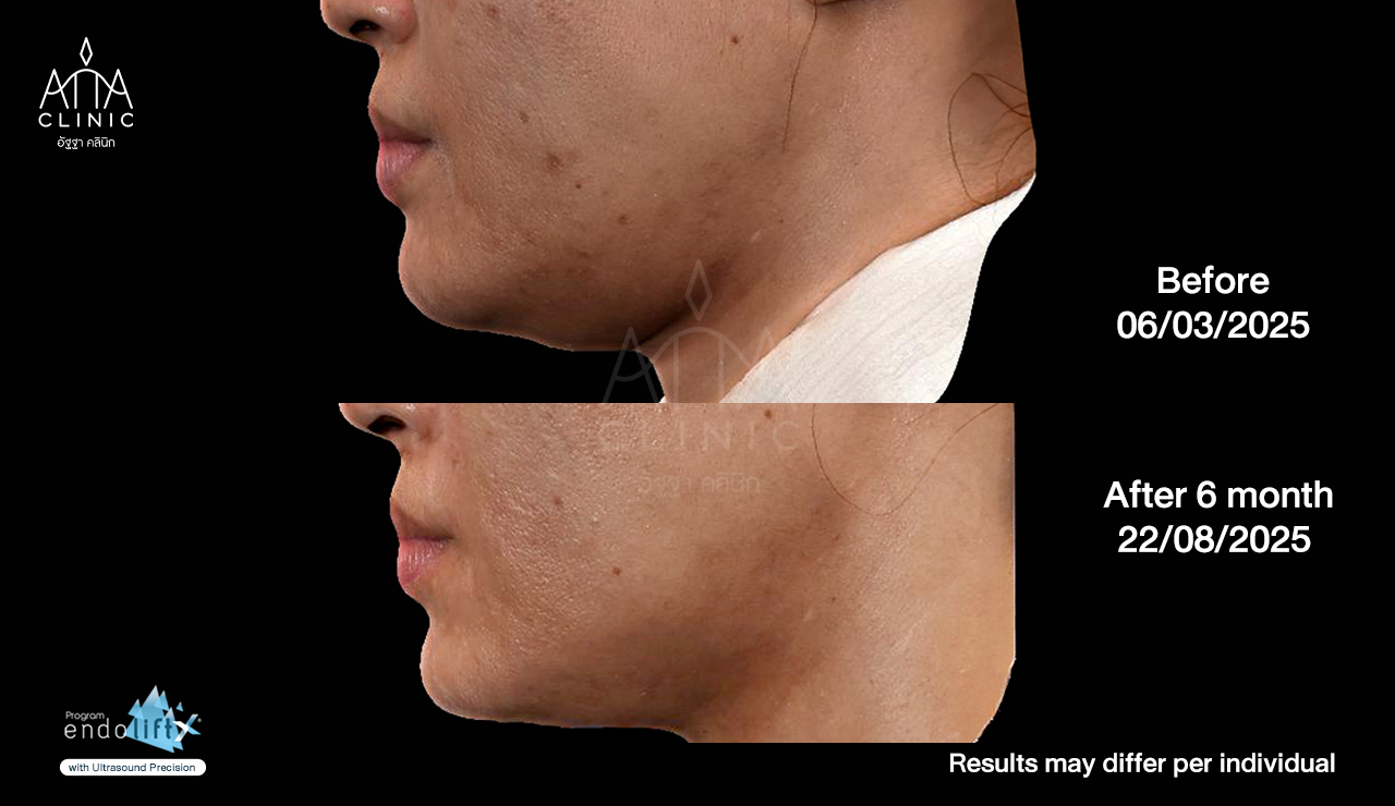 พี่น้ำนิ้ง4