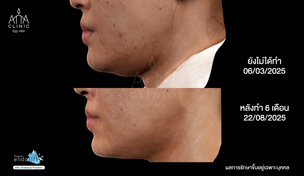 พี่น้ำนิ้ง4