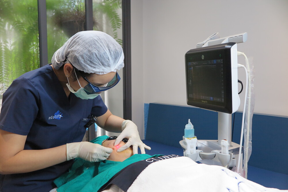 โปรแกรม Endolift ยกกระชับหน้าด้วยเลเซอร์ไฟเบอร์