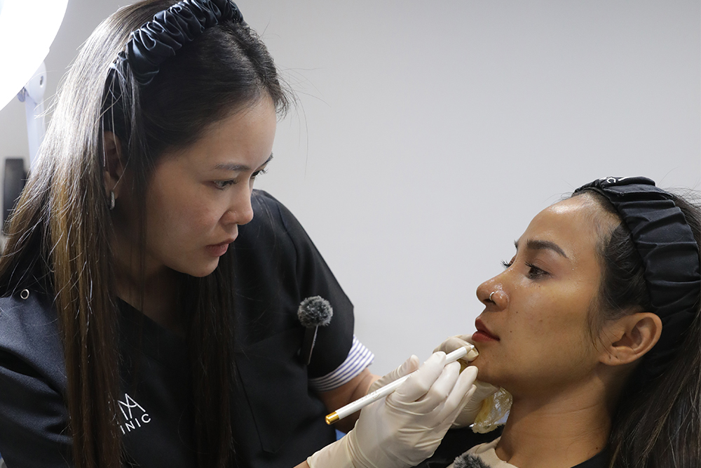 jawline-filler-facial-contouring-01
