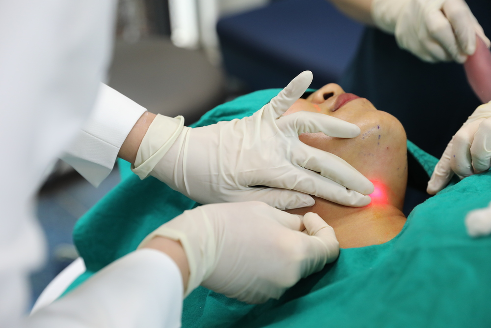 โปรแกรม Endolift ทำให้กรอบหน้าชัดขึ้น