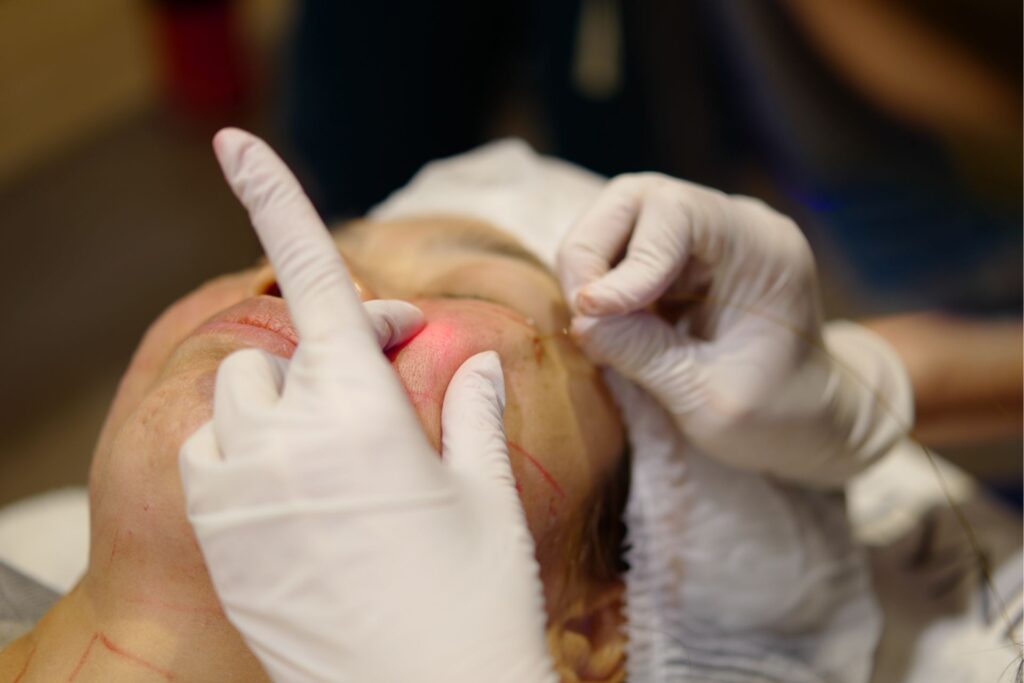 3-signs-need-endolift-ultrasound-facelift-01
