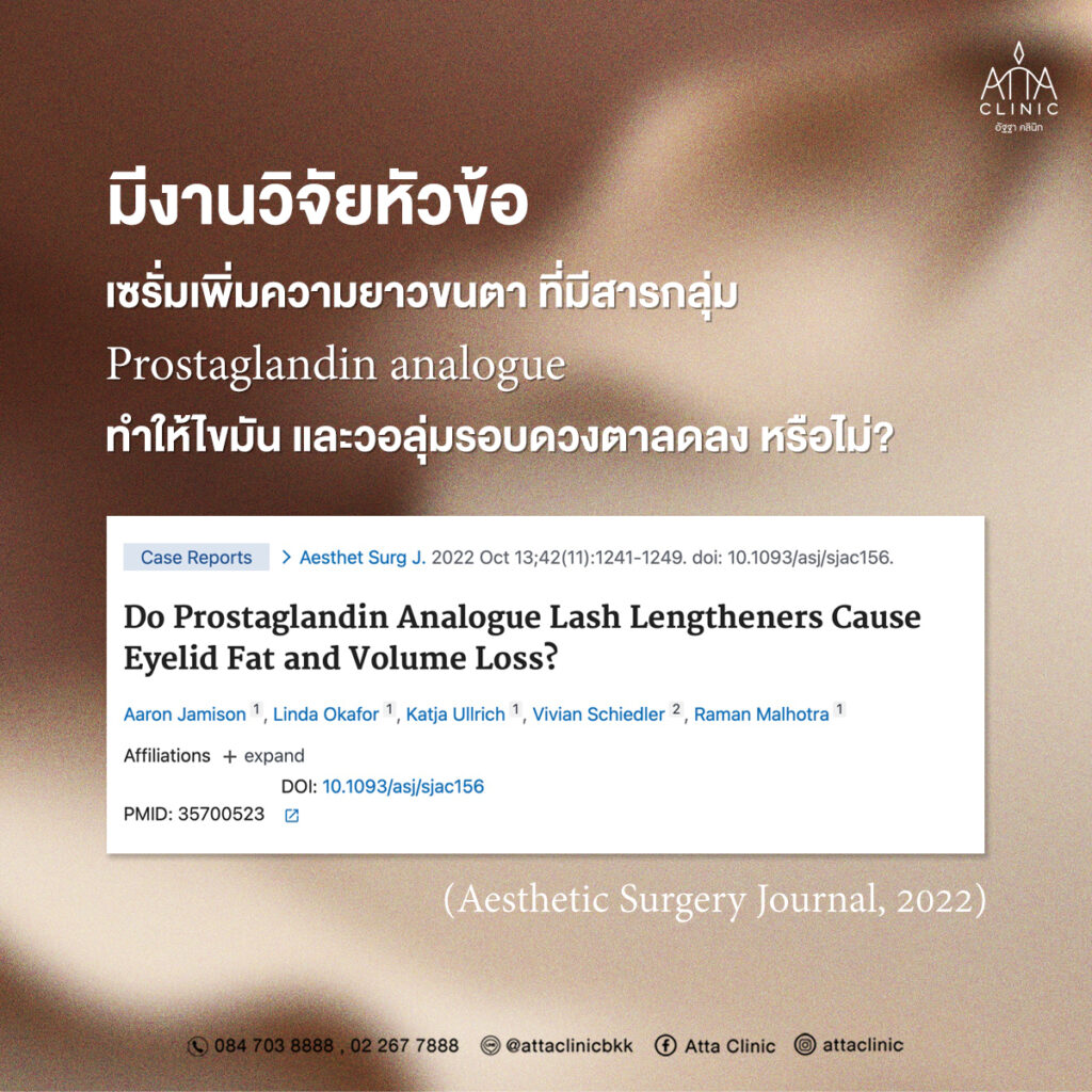 เซรั่มเพิ่มความยาวขนตาที่มีส่วนผสมของสารกลุ่ม Prostaglandin analogue ทำให้ไขมันและวอลุ่มรอบดวงตาลดลงหรือไม่?