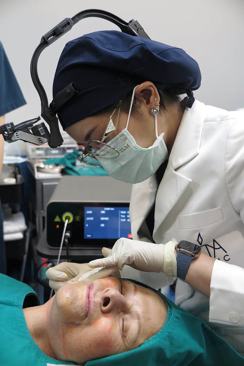 endolift-blog03