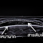รูปคุณเพ็ง ผลลัพธ์ (1280 x 740 px)