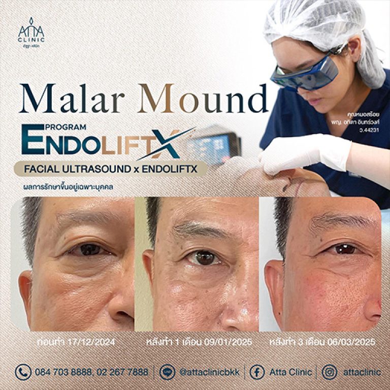 490197686_671873745589501_4441469018913861618_n