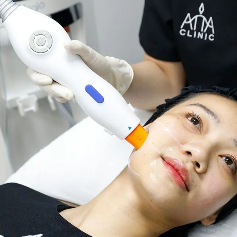 5-misconceptions-ultherapy-face-lifting-01