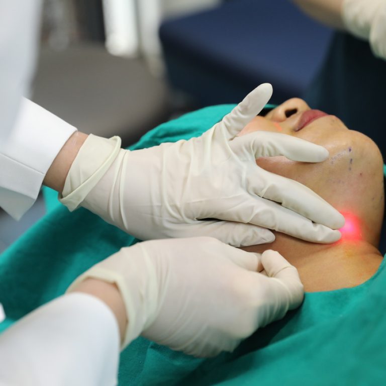 โปรแกรม Endolift ทำให้กรอบหน้าชัดขึ้น