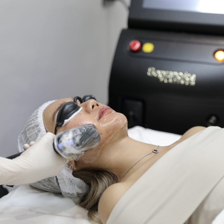 Hair Removal Laser หน้าใส ไร้ขน กำจัดขน
