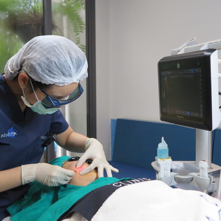โปรแกรม Endolift ยกกระชับหน้าด้วยเลเซอร์ไฟเบอร์