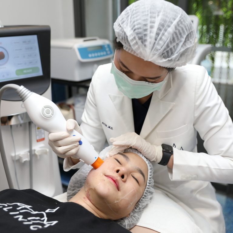 Oligio ลดเหนียง (1)