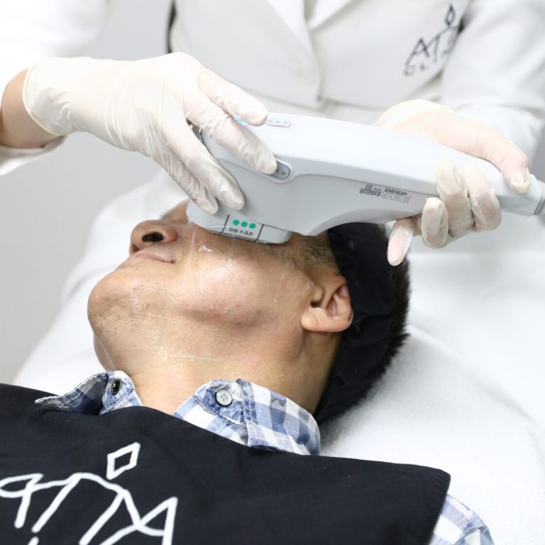 Ulthera อัลเทอร่า (2)