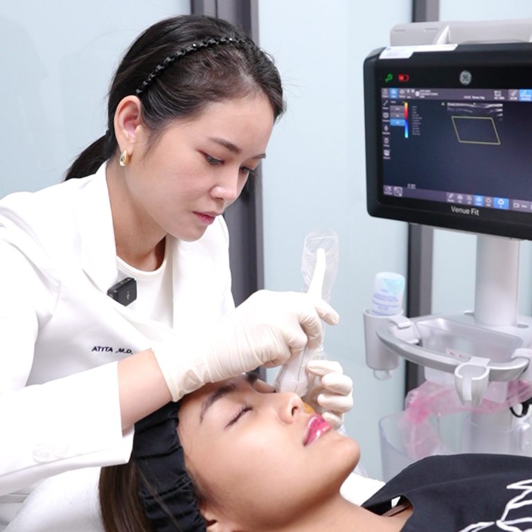 under-eye-filler-guide-01