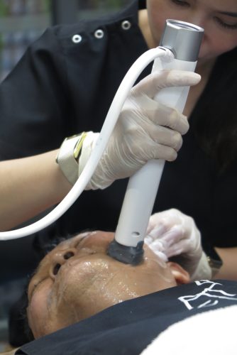 xerf-treatment-v-shape-without-needles-2