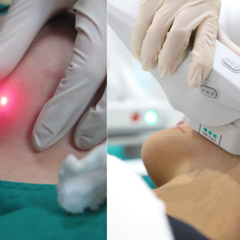 ดีไซน์ที่ยังไม่ได้ตั้งชื่อ