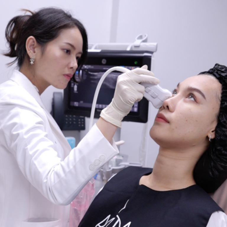 ฟิลเลอร์ใต้ตา ฟิลเลอร์ อัลตราซาวนด์นำทางฉีดฟิลเลอร์ ไม่เป็นก้อน-2