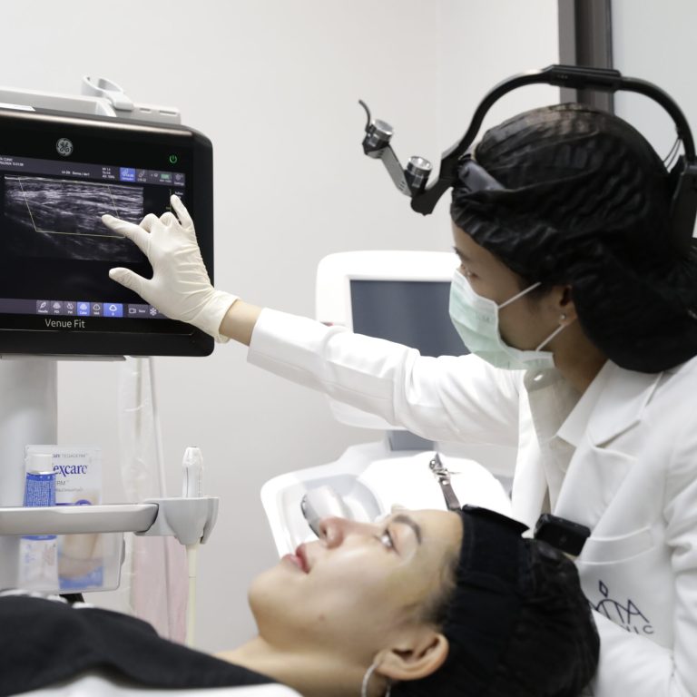 อัลตร้าซาวนด์ใบหน้า ฉีดฟิลเลอร์ ฟิลเลอร์ขมับ (3)